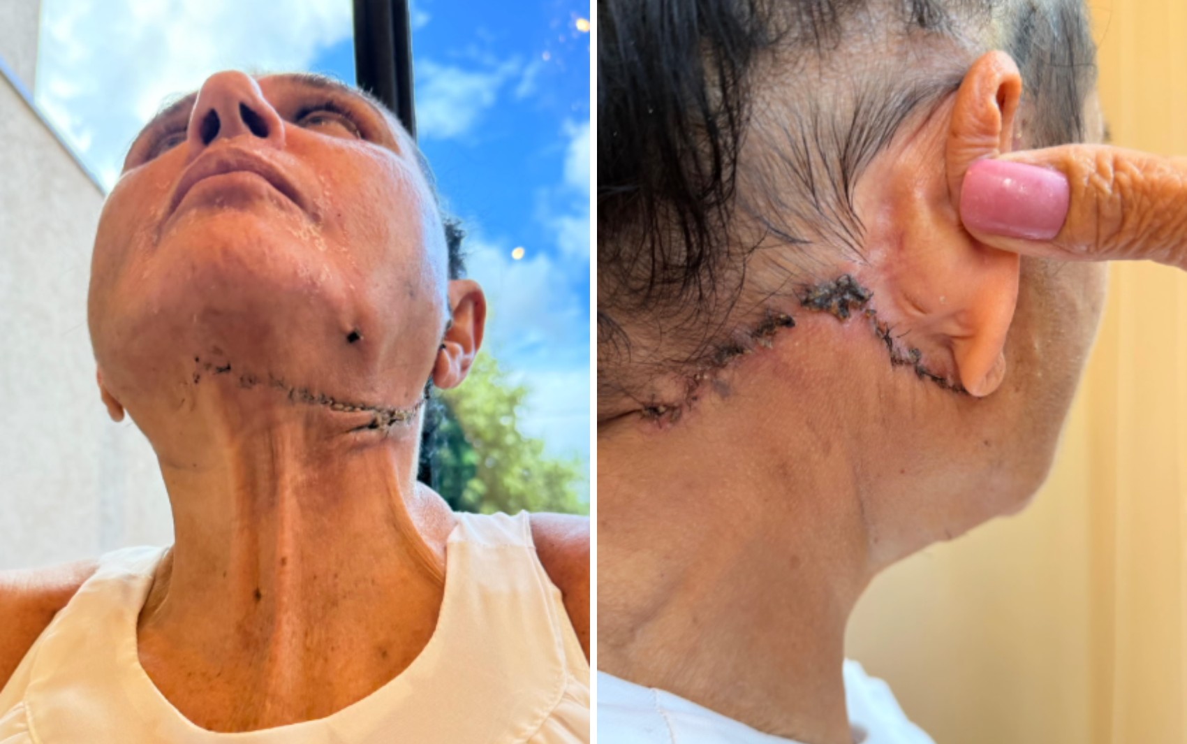 foto Not&iacute;cia Morro Agudo